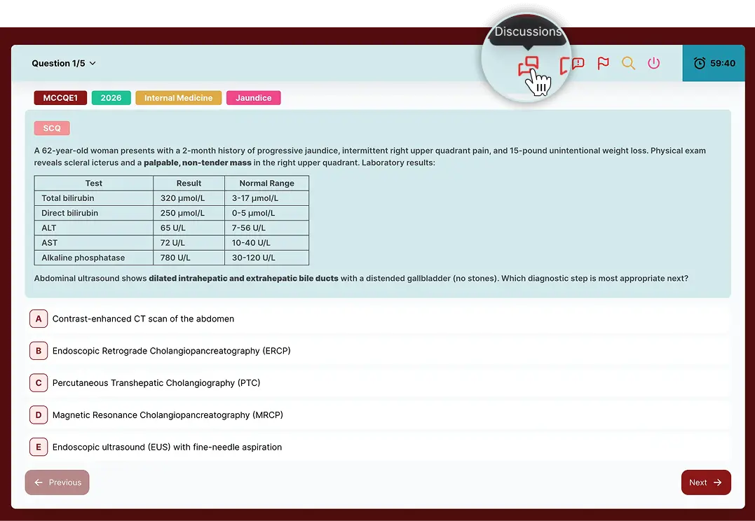 discussion icon hovered